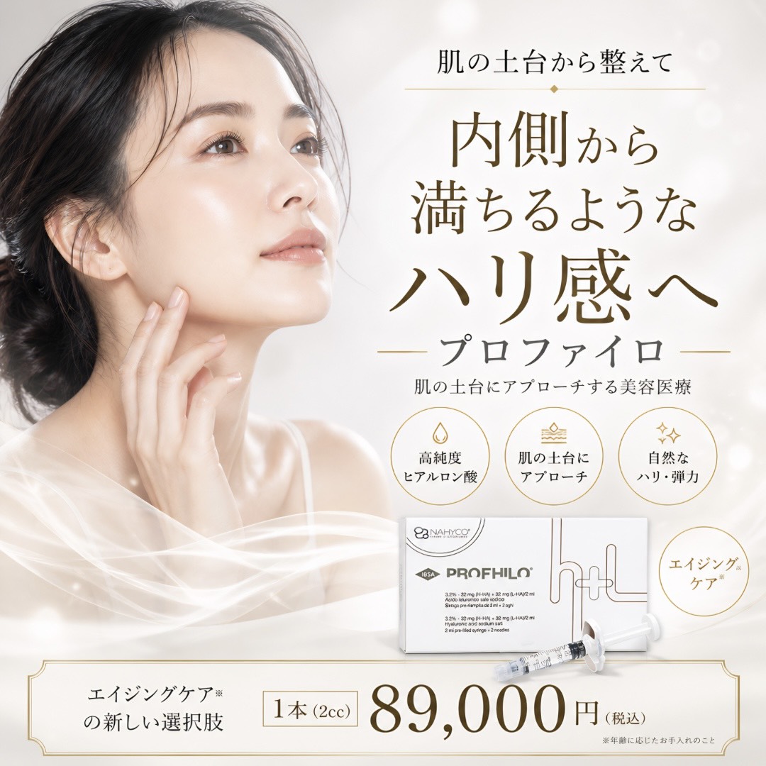 プロファイロ