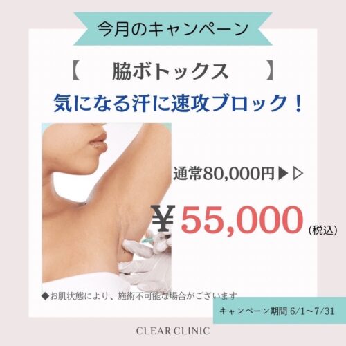 脇ボトックス