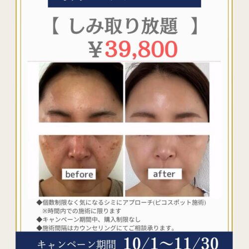 ピコスポット取り放題キャンペーン✨