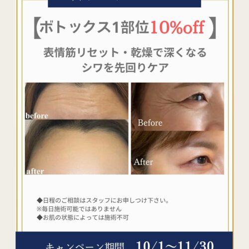 💉ボトックス1部位10％OFFキャンペーン✨
